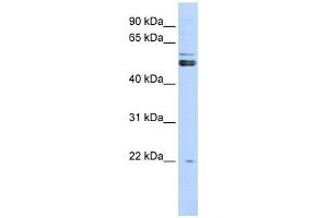 PRMT2 antibody used at 1 ug/ml to detect target protein. (PRMT2 anticorps  (N-Term))
