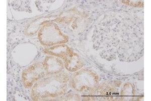 Image no. 2 for anti-Peptidase Inhibitor 15 (PI15) (AA 18-118) antibody (ABIN599240) (PI15 anticorps  (AA 18-118))