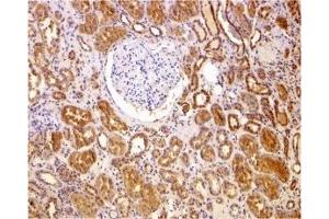 Immunohistochemistry (IHC) image for anti-B-Cell CLL/lymphoma 2 (BCL2) (N-Term) antibody (ABIN1031266) (Bcl-2 anticorps  (N-Term))