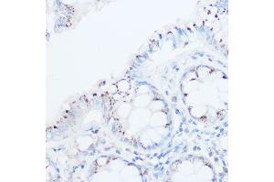 Immunohistochemistry of paraffin-embedded human colon using UBI Rabbit pAb (ABIN6134945, ABIN6149844, ABIN6149847 and ABIN6218504) at dilution of 1:500 (40x lens). (UBIAD1 anticorps  (AA 1-100))