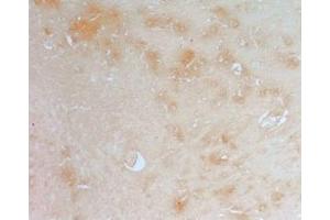 Rat brain tissue was stained by anti-AdipoR2 (374-386) (Human) Antiserum