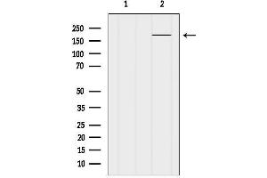 anti-Kinase D-Interacting Substrate, 220kDa (KIDINS220) (Internal Region) antibody