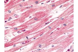 Staining of human heart myocytes using ABIN121975 (CCRL1 anticorps)