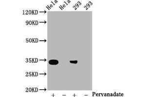 Western Blot Positive WB detected in:Hela whole cell lysate, 293 whole cell lysate(treated with Pervanadate or not) All lanes:Phospho-CDK2 antibody at 0.
