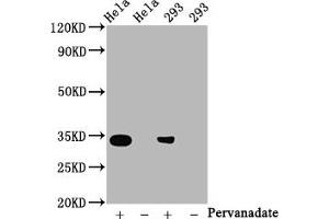 Western Blot Positive WB detected in:Hela whole cell lysate, 293 whole cell lysate(treated with Pervanadate or not) All lanes:Phospho-CDK2 antibody at 0. (Recombinant CDK2 anticorps  (pTyr15))