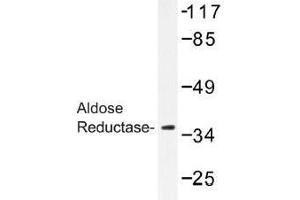 Image no. 1 for anti-Aldo-Keto Reductase Family 1, Member B1 (Aldose Reductase) (AKR1B1) antibody (ABIN317815) (AKR1B1 anticorps)