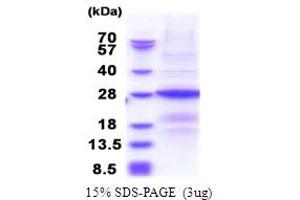 SDS-PAGE (SDS) image for B9 Protein Domain 1 (B9D1) (AA 1-204) protein (His tag) (ABIN5853866) (B9D1 Protein (AA 1-204) (His tag))