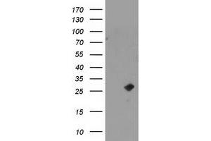 Western Blotting (WB) image for anti-Cyclin-Dependent Kinase Inhibitor 3 (CDKN3) antibody (ABIN1497459) (CDKN3 anticorps)