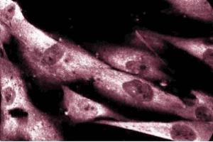 Immunoflouresence staining of human fibroblasts. (DAP Kinase 1 anticorps  (AA 694-947))