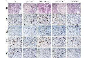 In vivo antitumor effect of miRNA-siRNA combination.
