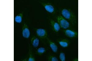 IF analysis of OFD1 using anti-OFD1 antibody (ABIN7602739). (OFD1 anticorps  (C-Term))