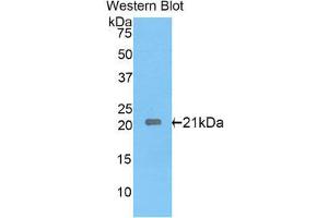 Western Blotting (WB) image for anti-Interleukin 17 Receptor E (IL17RE) (AA 457-626) antibody (ABIN1859366)