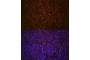 Immunofluorescence analysis of human spleen using SHIP11 Rabbit mAb (ABIN7267882) at dilution of 1:100 (40x lens). (INPP5D anticorps)