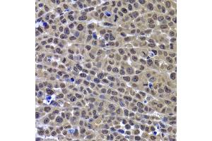 Immunohistochemistry of paraffin-embedded mouse cancer using GPS1 antibody. (GPS1 anticorps)