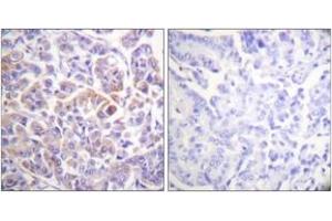 Immunohistochemistry (IHC) image for anti-V-Raf-1 Murine Leukemia Viral Oncogene Homolog 1 (RAF1) (AA 271-320) antibody (ABIN2888728) (RAF1 anticorps  (AA 271-320))