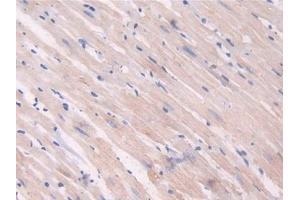 Used in DAB staining on fromalin fixed paraffin- embedded heart tissue (IDO anticorps  (AA 106-190))