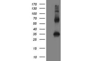 Image no. 2 for anti-Snail Family Zinc Finger 2 (SNAI2) antibody (ABIN1500979) (SLUG anticorps)