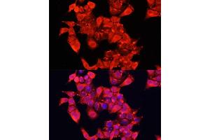 Immunofluorescence analysis of HeLa cells using  Polyclonal Antibody (ABIN6129956, ABIN6136944, ABIN6136945 and ABIN6221849) at dilution of 1:100 (40x lens). (DAO anticorps  (AA 20-300))