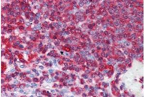 Human Spleen: Formalin-Fixed, Paraffin-Embedded (FFPE)