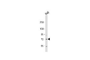 Anti-KLHL6 Antibody (C-term) at 1:1000 dilution + Raji whole cell lysate Lysates/proteins at 20 μg per lane.