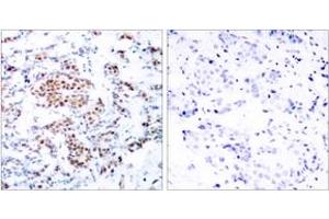 Immunohistochemistry (IHC) image for anti-Signal Transducer and Activator of Transcription 5A (STAT5A) (AA 666-715) antibody (ABIN2889069) (STAT5A anticorps  (AA 666-715))