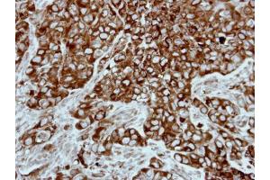 IHC-P Image Immunohistochemical analysis of paraffin-embedded H661 xenograft, using PPP3CB, antibody at 1:500 dilution.