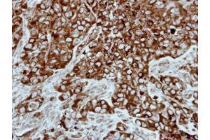 IHC-P Image Immunohistochemical analysis of paraffin-embedded H661 xenograft, using PPP3CB, antibody at 1:500 dilution. (PPP3CB anticorps  (Center))