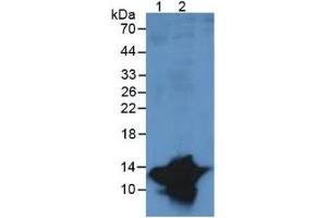 Rabbit Detection antibody from the kit in WB with Positive Control:  Sample Lane1: Human Serum; Lane2: Human Leukocyte Cells.