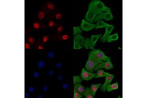 Phospho-MyoD1 (Ser200) Antibody staining Hela cells(heat shock treatment) by IF/ICC.