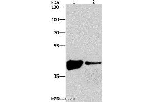 Western blot analysis of 293T and human fetal brain tissue, using MAPK11  Polyclonal Antibody at dilution of 1:200 (MAPK11 anticorps)