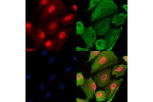Phospho-RAD18 (Ser99) Antibody staining A549 cells(H2O2 treatment) by IF/ICC. (RAD18 anticorps  (pSer99))