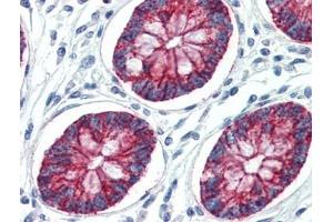 Human Colon (formalin-fixed, paraffin-embedded) stained with CLDN1at 10 µg/ml followed by biotinylated goat anti-rabbit IgG secondary antibody, alkaline phosphatase-streptavidin and chromogen. (Claudin 1 anticorps  (C-Term))