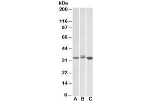Western blot testing of Daudi (A), Jurkat (B) and K562 (C) lysates with LIVIN antibody at 0. (BIRC7 anticorps)