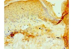 Immunohistochemistry of paraffin-embedded human skin tissue using ABIN7164787 at dilution of 1:100 (P4HA3 anticorps  (AA 20-544))