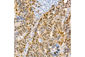 Immunohistochemistry of paraffin-embedded Human liver (negative control sample) using Y antibody (ABIN7271418) at dilution of 1:1000 (40x lens).