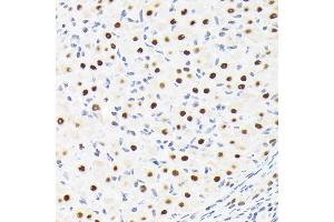 Immunohistochemistry of paraffin-embedded rat ovary using SUPT5H/SPT5 Rabbit mAb (ABIN7270878) at dilution of 1:100 (40x lens). (SUPT5H anticorps)