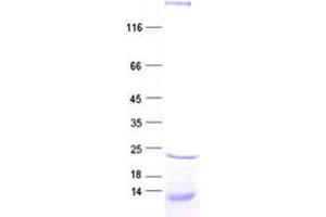 Validation with Western Blot