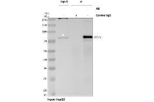 anti-Synovial Apoptosis Inhibitor 1, Synoviolin (SYVN1) (AA 68-604) antibody