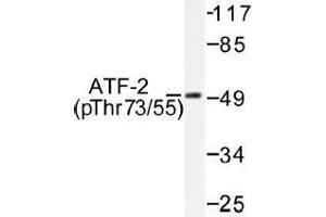 Image no. 1 for anti-Activating Transcription Factor 2 (ATF2) (pThr55), (pThr73) antibody (ABIN317967) (ATF2 anticorps  (pThr55, pThr73))