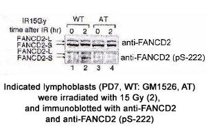 Image no. 1 for anti-Fanconi Anemia, Complementation Group D2 (FANCD2) (AA 217-226), (pSer222) antibody (ABIN363448)