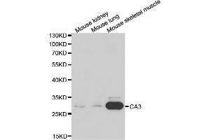 Western blot analysis of extracts of various cell lines, using CA3 antibody. (CA3 anticorps)
