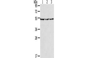 Gel: 8 % SDS-PAGE, Lysate: 40 μg, Lane 1-3: PC3 cells, hela cells, A549 cells, Primary antibody: ABIN7191485(MMP23B Antibody) at dilution 1/200, Secondary antibody: Goat anti rabbit IgG at 1/8000 dilution, Exposure time: 10 seconds (MMP23A anticorps)