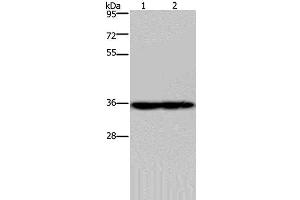 Western Blot analysis of Mouse heart and kidney tissue using NDUFA9 Polyclonal Antibody at dilution of 1:400 (NDUFA9 anticorps)