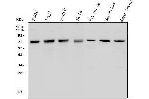 Western blot analysis of MCPIP1/ZC3H12A using anti-MCPIP1/ZC3H12A antibody (ABIN7601482).