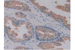 Figure. (Kallikrein 10 anticorps  (AA 35-276))