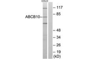 Western blot analysis of extracts from COLO cells, using ABCB10 Antibody. (ABCB10 anticorps  (AA 441-490))