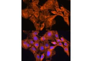Immunofluorescence analysis of C6 cells using  Rabbit pAb (ABIN1678678, ABIN3017841, ABIN3017842 and ABIN6220287) at dilution of 1:100.