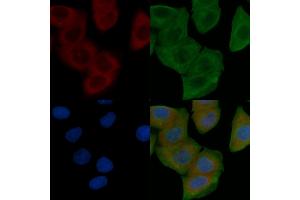 ABIN6259263 and ABIN6274611 staining Hela cells by IF/ICC. (TMEM30B anticorps  (Internal Region))