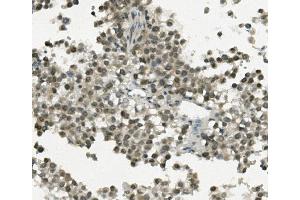 IHC analysis of REC8 using anti-REC8 antibody (ABIN7599473). (REC8 anticorps  (AA 1-547))