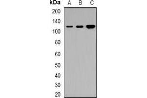 Western blot analysis of Tensin 3 expression in HeLa (A), DLD (B), H9C2 (C) whole cell lysates. (TNS3 anticorps)